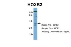 HOXB2 Rabbit anti-Human, Polyclonal, Novus Biologicals 0.1 mL | Buy Online | Novus Biologicals | Fisher Scientific