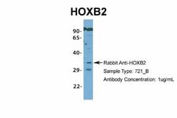 HOXB2 Rabbit anti-Human, Polyclonal, Novus Biologicals 0.1 mL | Buy Online | Novus Biologicals | Fisher Scientific
