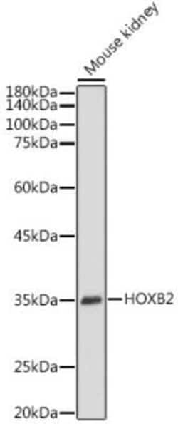 HOXB2 Rabbit anti-Mouse, Rat, Polyclonal, Novus Biologicals 100 &mu;g;