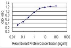 HOXB6 Antibody (8E3), Novus Biologicals 100 &mu;g | Buy Online | Novus Biologicals | Fisher Scientific
