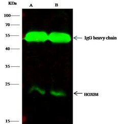 HOXB8 Antibody, Novus Biologicals 50 &mu;g, Unconjugated:Antibodies, Polyclonal