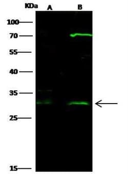 HOXB8 Antibody, Novus Biologicals 50 &mu;g, Unconjugated:Antibodies, Polyclonal