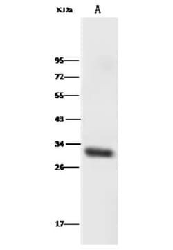HOXB8 Antibody, Novus Biologicals 50 &mu;g; Unconjugated:Antibodies, Polyclonal