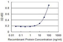 HOXB9 Antibody (4C3), Novus Biologicals 0.1 mg | Buy Online | Novus Biologicals | Fisher Scientific