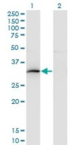HOXB9 Antibody (4C3), Novus Biologicals 0.1 mg | Buy Online | Novus Biologicals | Fisher Scientific