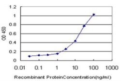 Novus Biologicals HOXC12 Antibody (2E9), Novus Biologicals 0.1 mg | Buy Online | Novus Biologicals&trade; | Fisher Scientific