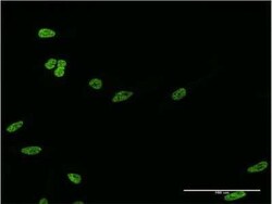 Novus Biologicals HOXC12 Antibody (3E1), Novus Biologicals 0.1 mg | Buy Online | Novus Biologicals&trade; | Fisher Scientific