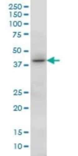 HOXC13 Antibody (10D4), Novus Biologicals 0.1 mg | Buy Online | Novus Biologicals | Fisher Scientific