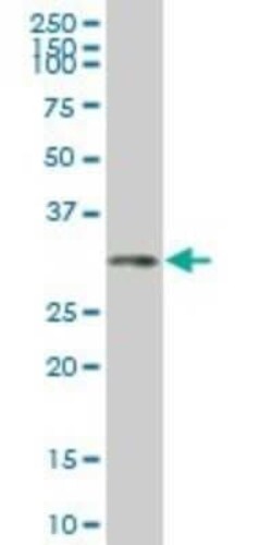 HOXC4 Antibody (2D6), Novus Biologicals 0.1 mg | Buy Online | Novus Biologicals | Fisher Scientific