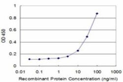 Novus Biologicals HOXC5 Antibody (1E10), Novus Biologicals 0.1 mg | Buy Online | Novus Biologicals&trade; | Fisher Scientific