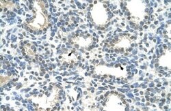 HOXC9 Antibody, Novus Biologicals 100 &mu;L; Unconjugated:Antibodies, Polyclonal