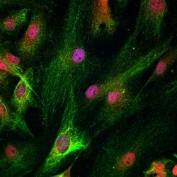 Human HOXD10 Antibody, R D Systems:Antibodies:Primary Antibodies