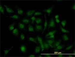 HOXD11 Antibody (5E7), Novus Biologicals 0.1 mg | Buy Online | Novus Biologicals | Fisher Scientific