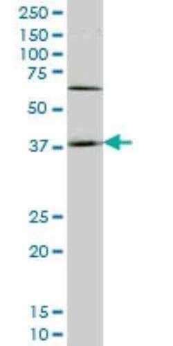 HOXD11 Antibody (5E7), Novus Biologicals 0.1 mg | Buy Online | Novus Biologicals | Fisher Scientific