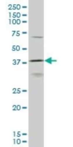 HOXD11 Antibody (6C8), Novus Biologicals 0.1 mg | Buy Online | Novus Biologicals | Fisher Scientific
