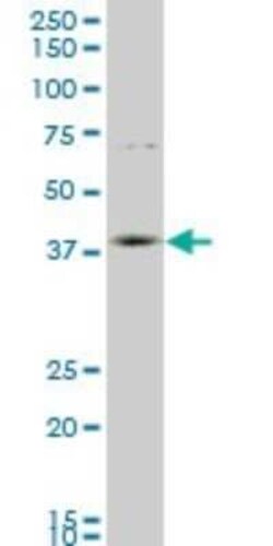 HOXD11 Antibody (6D8), Novus Biologicals 0.1 mg | Buy Online | Novus Biologicals | Fisher Scientific