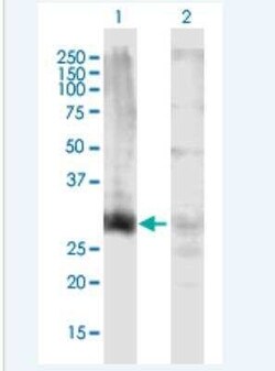 HOXD13 Antibody, Novus Biologicals 50 &mu;g | Buy Online | Novus Biologicals | Fisher Scientific