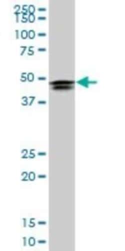HOXD3 Antibody (1B12), Novus Biologicals 0.1 mg, Unconjugated:Antibodies,