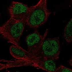 HOXD4 Antibody, Novus Biologicals 25 &mu;L, Unconjugated:Antibodies, Polyclonal
