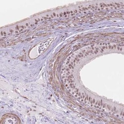 HOXD4 Antibody, Novus Biologicals 25 &mu;L, Unconjugated:Antibodies, Polyclonal