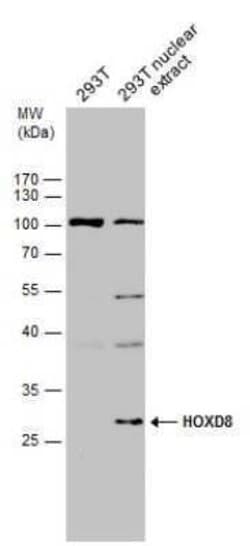 HOXD8 Antibody, Novus Biologicals 100 &mu;g; Unconjugated:Antibodies, Polyclonal