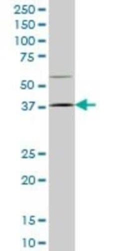 HOXD9 Antibody (2A9), Novus Biologicals 0.1 mg | Buy Online | Novus Biologicals | Fisher Scientific
