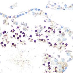 HP1 alpha Rabbit anti-Human, Mouse, Rat, Clone: 8C3M6, Novus Biologicals:Antibodies:Primary