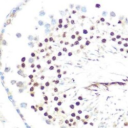 HP1 alpha Rabbit anti-Human, Mouse, Rat, Clone: 8C3M6, Novus Biologicals:Antibodies:Primary