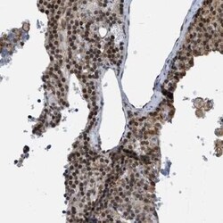 HP1 alpha Antibody, Novus Biologicals 0.1 mL | Buy Online | Novus Biologicals | Fisher Scientific