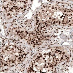 HP1 alpha Antibody, Novus Biologicals 0.1 mL | Buy Online | Novus Biologicals | Fisher Scientific