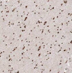 HP1 alpha Antibody, Novus Biologicals 0.1 mL | Buy Online | Novus Biologicals | Fisher Scientific