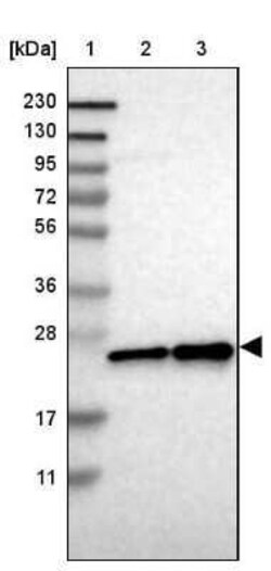 HP1 alpha Antibody, Novus Biologicals 0.1 mL | Buy Online | Novus Biologicals | Fisher Scientific