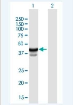 HPR Antibody, Novus Biologicals 50 &mu;g | Buy Online | Novus Biologicals | Fisher Scientific