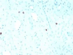 HPV16 Mouse anti-Virus, Clone: rHPV16L1/1058, Novus Biologicals 20 &mu;g;
