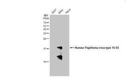 HPV16 E6 Antibody, Novus Biologicals 100 &mu;g | Buy Online | Novus Biologicals | Fisher Scientific