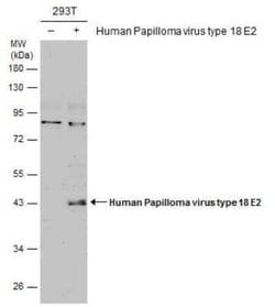 HPV18 E2 Antibody, Novus Biologicals 100 &mu;g | Buy Online | Novus Biologicals | Fisher Scientific