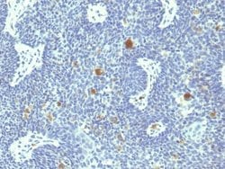 HPV18 E6 Antibody (HPV18/1297) - Azide and BSA Free, Novus Biologicals 100 &mu;g | Buy Online | Novus Biologicals | Fisher Scientific