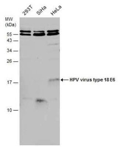 HPV18 E6 Antibody, Novus Biologicals 100 &mu;g | Buy Online | Novus Biologicals | Fisher Scientific