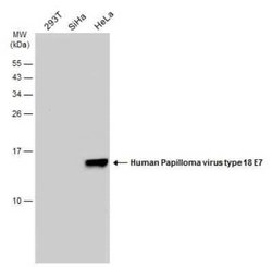 HPV18 E7 Antibody (GT881), Novus Biologicals 100 &mu;g; Unconjugated:Antibodies,