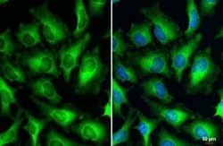HPV18 E7 Antibody, Novus Biologicals 100 &mu;g; Unconjugated:Antibodies,