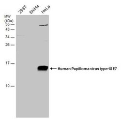 HPV18 E7 Antibody, Novus Biologicals 100 &mu;g; Unconjugated:Antibodies,