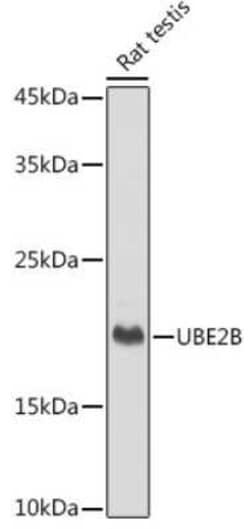 HR6B/UBE2B Rabbit anti-Human, Mouse, Rat, Clone: 2Z3R2, Novus Biologicals 100 &mu;g | Buy Online | Novus Biologicals | Fisher Scientific
