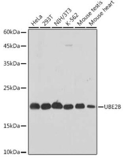 HR6B/UBE2B Rabbit anti-Human, Mouse, Rat, Clone: 2Z3R2, Novus Biologicals 100 &mu;g | Buy Online | Novus Biologicals | Fisher Scientific