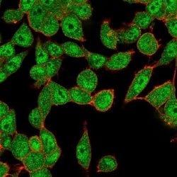 HR6B/UBE2B Antibody (PCRP-UBE2B-1C7) - Azide and BSA Free, Novus Biologicals