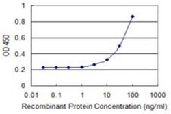 Novus Biologicals HR6B/UBE2B Antibody (1F11), Novus Biologicals 0.1 mg | Buy Online | Novus Biologicals&trade; | Fisher Scientific