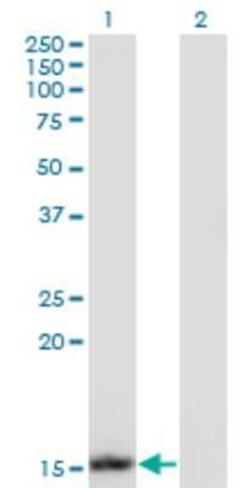 Novus Biologicals HR6B/UBE2B Antibody (1F11), Novus Biologicals 0.1 mg | Buy Online | Novus Biologicals&trade; | Fisher Scientific