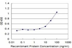 HR6B/UBE2B Antibody (4C3), Novus Biologicals 0.1 mg | Buy Online | Novus Biologicals | Fisher Scientific