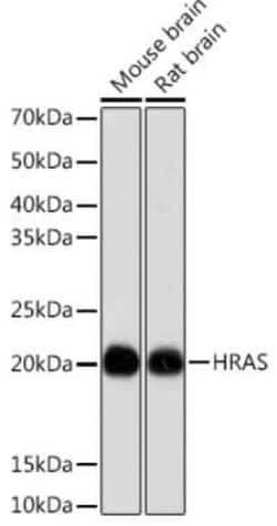 HRAS Rabbit anti-Human, Mouse, Rat, Clone: 4Q7M5, Novus Biologicals 20 &mu;g | Buy Online | Novus Biologicals | Fisher Scientific