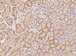 HRAS like suppressor Antibody, Novus Biologicals 50 &mu;g; Unconjugated:Antibodies,