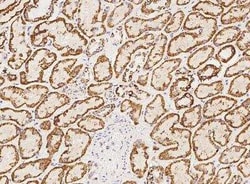 HRASLS2 Antibody, Novus Biologicals 50 &mu;g | Buy Online | Novus Biologicals | Fisher Scientific